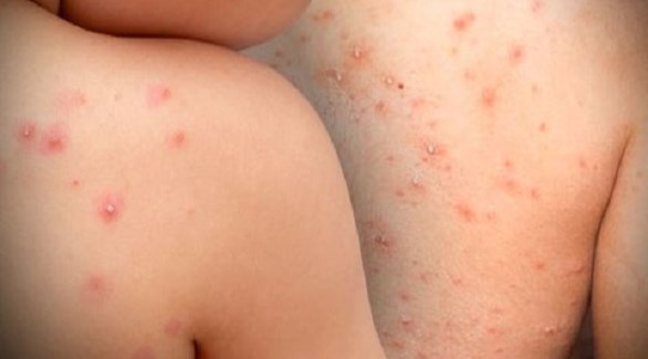 لهذا السبب.. ماليزيا تغلق 180 روضة أطفال