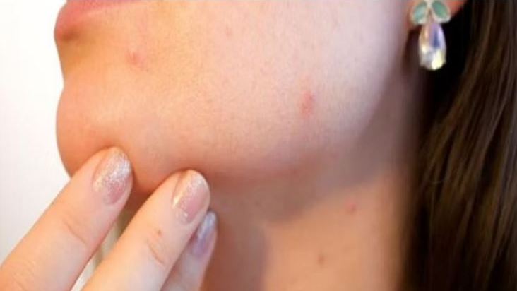 اجراءات عُمانية لمنع مرور جدري القرود