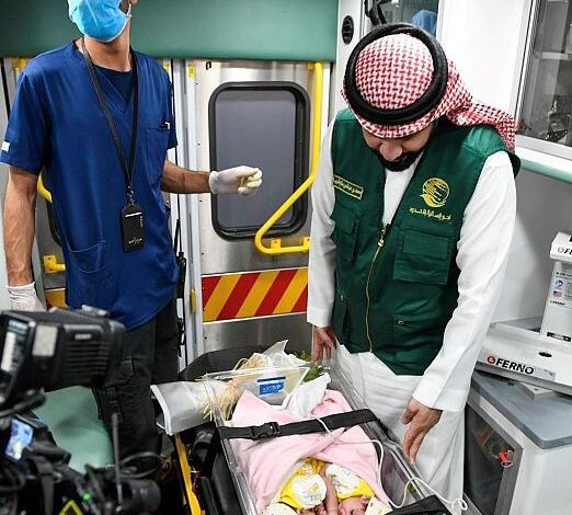 التوأم السيامي اليمني