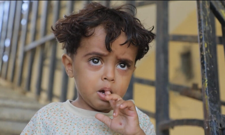 الطفل اليمني أمير شريف